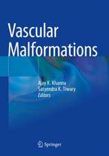 Vascular Malformations