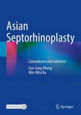 Asian Septorhinoplasty: Conundrums and Solutions