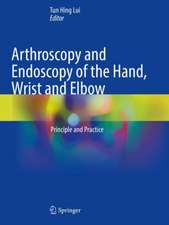 Arthroscopy and Endoscopy of the Hand, Wrist and Elbow: Principle and Practice