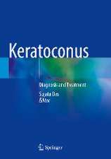 Keratoconus: Diagnosis and Treatment