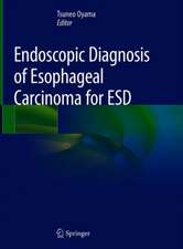 Endoscopic Diagnosis of Esophageal Carcinoma for ESD