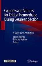 Compression Sutures for Critical Hemorrhage During Cesarean Section: A Guide by CG Animation