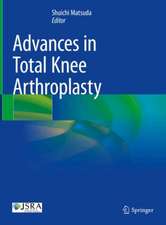 Advances in Total Knee Arthroplasty