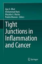 Tight Junctions in Inflammation and Cancer