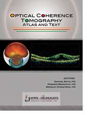 Optical Coherence Tomography