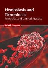 Hemostasis and Thrombosis: Principles and Clinical Practice