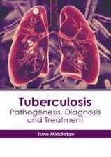 Tuberculosis: Pathogenesis, Diagnosis and Treatment